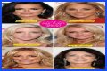 Botox, Implants & More! – Hollywood Life