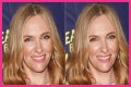 Toni Collette Teeth Before And After | What Is Wrong With Her Face